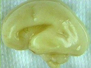Illustration of a brain at 24 weeks