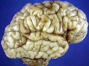 Illustration of a brain at 40 weeks